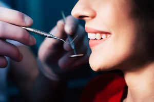 A photo of beautiful smile made by the professional dentist who is checking the result after some time with the help of dentist instruments.