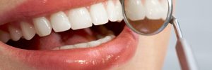 Close-up of patient’s healthy smile with mirror near by