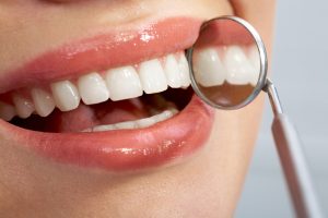 Close-up of patient’s healthy smile with mirror near by