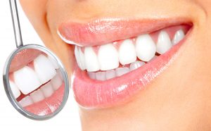 Healthy woman teeth and a dentist mouth mirror