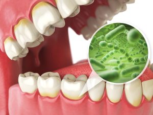 Bacterias and viruses around tooth. Dental hygiene medical concept. 3d illustration