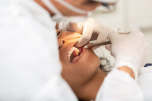 Young woman being seen in a dentist's office. Concept of toothache, wisdom tooth extraction, anesthesia, problems with caries or gums. Oral health care. Dentist day.