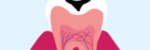 vector background of tooth decay