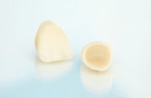 Metal free ceramic dental crowns