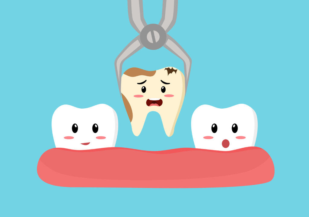 Auburn Hills, MI, dentist offers tooth extractions 
